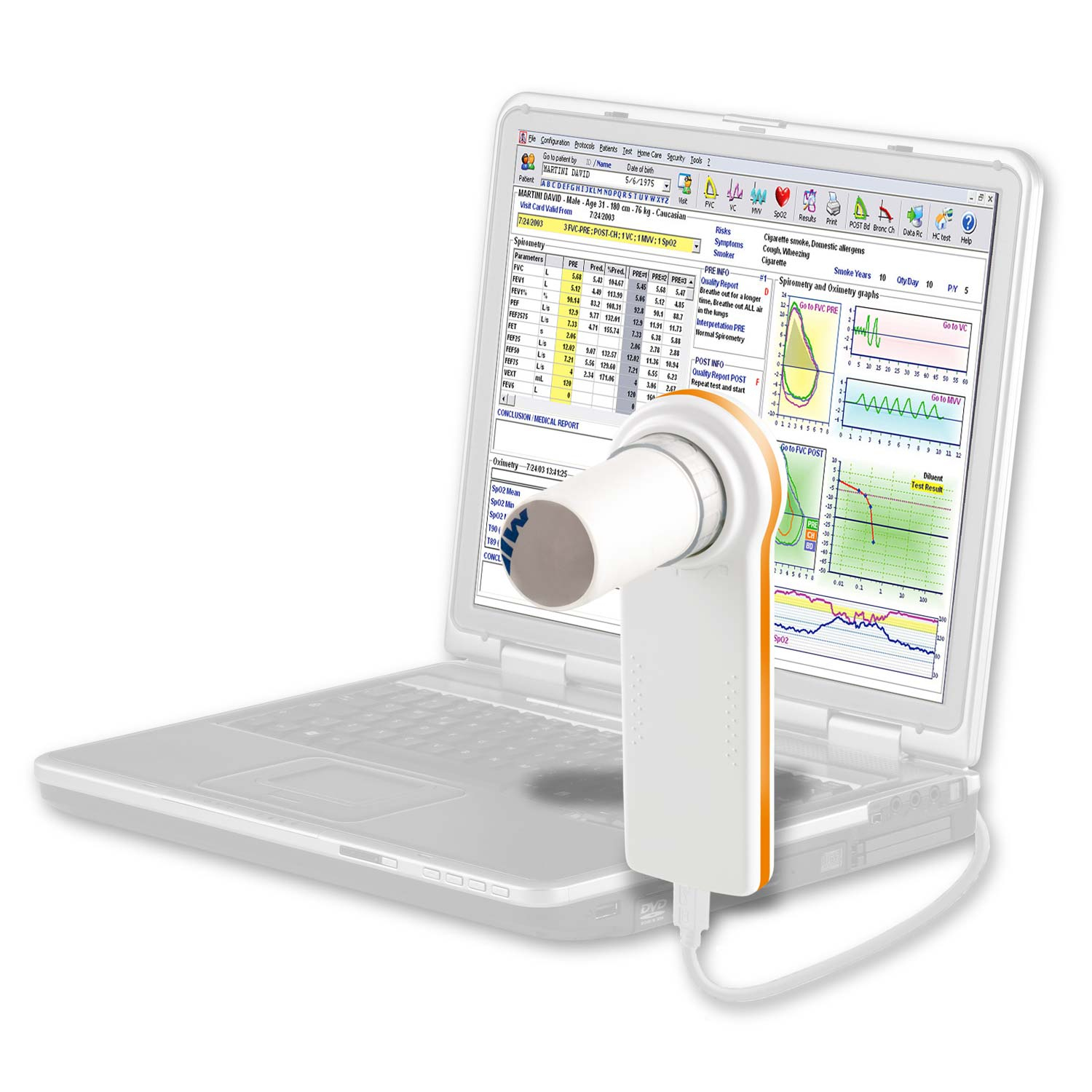 MiniSpir MIR New Spirometer PC Based USB Pulmonary Function Testing ...